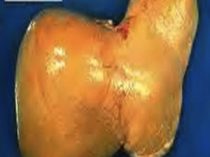 Diapositiva1