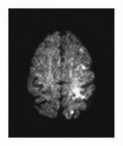 Cerebro