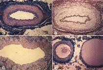 Arteria Normal y Vena