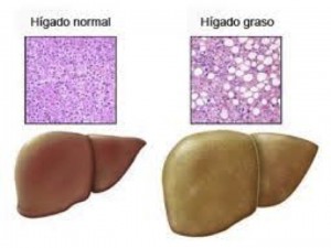 Diapositiva1